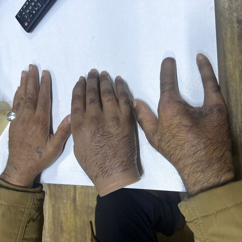 مقارنة اليد الصناعية